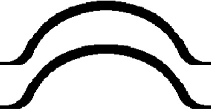 Ajusa 59014200 Прокладка піддону оливи