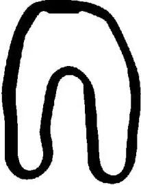 Victor Reinz 71-24794-10 Прокладка кришки клапанів Victor Reinz 71-24794-10 Прокладка кришки клапанів